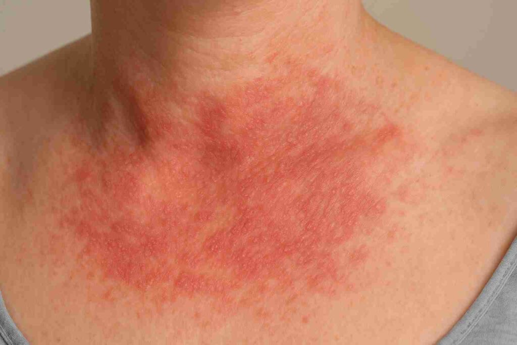 Dermatitis 1 ChatGPT Image 10 dic 2025 10 01 00 p.m. 2 11zon